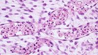 Research image through a microscope